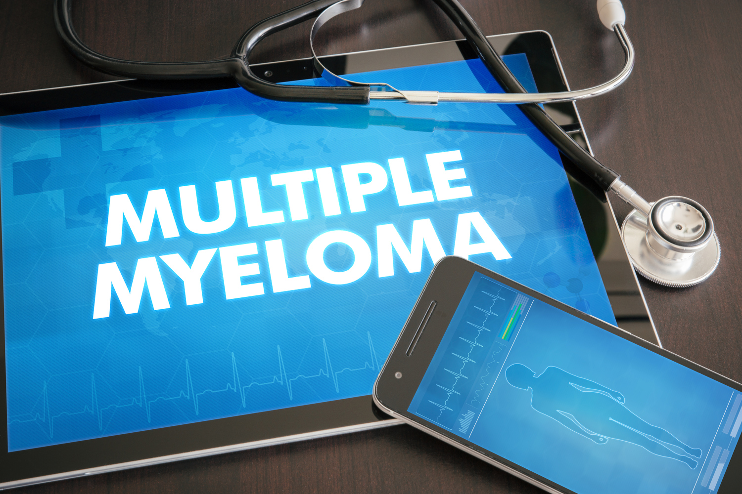 Multiple Myeloma Risk Factors