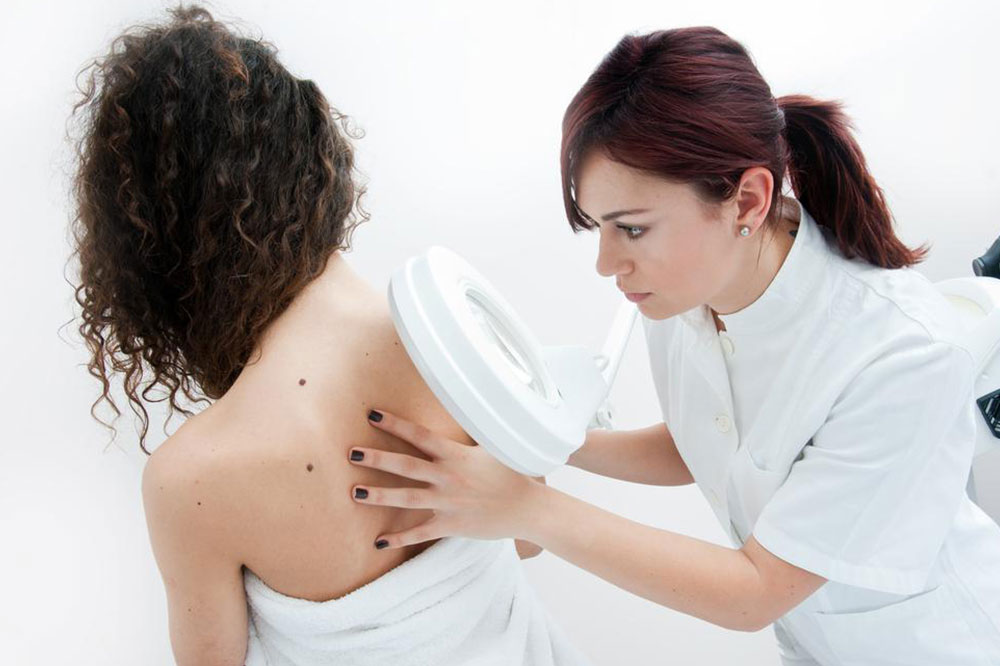 Top Causes and Stages of Melanoma