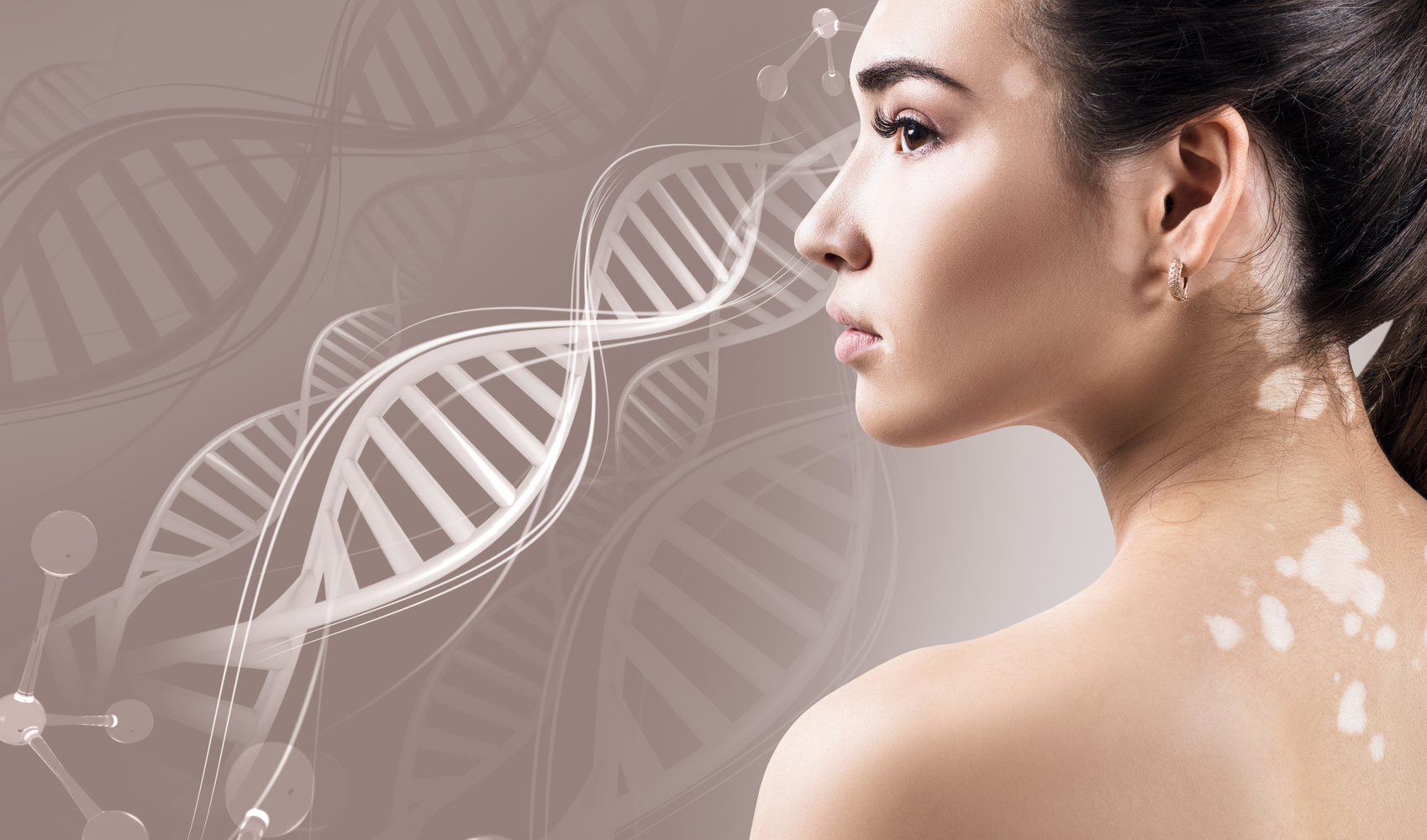 Early Signs of Vitiligo